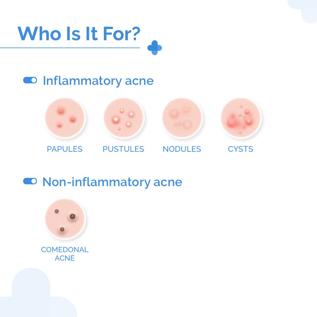 2.5% Benzoyl Peroxide Gel Face Wash with Glycerin & Allantoin for Active Acne - 100 ml