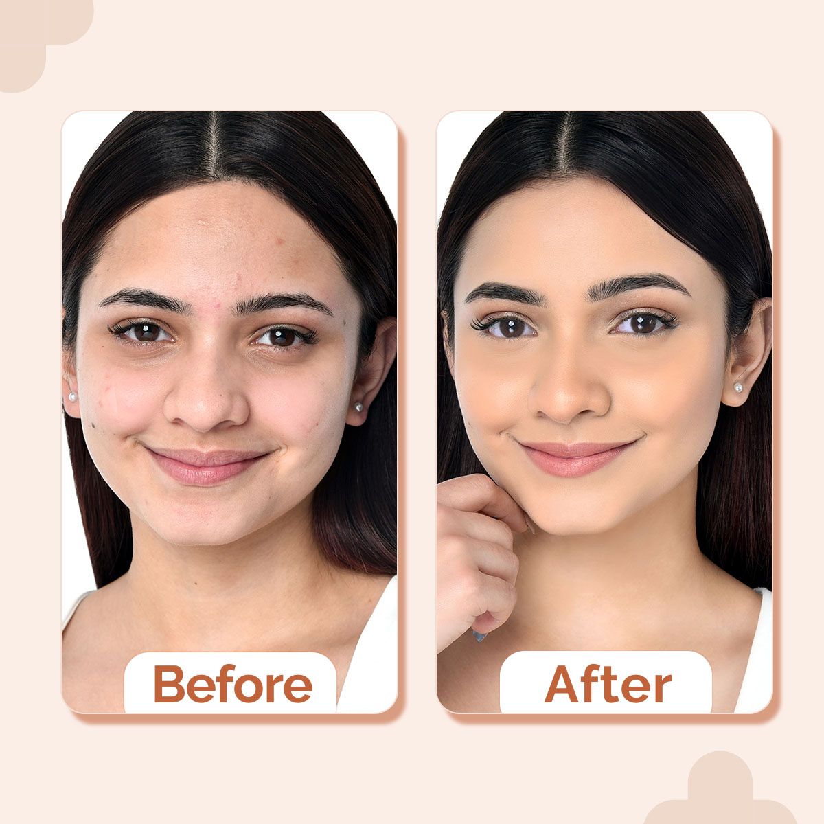 1% Hyaluronic Hydrating High Coverage Foundation - 18ml | Ivory