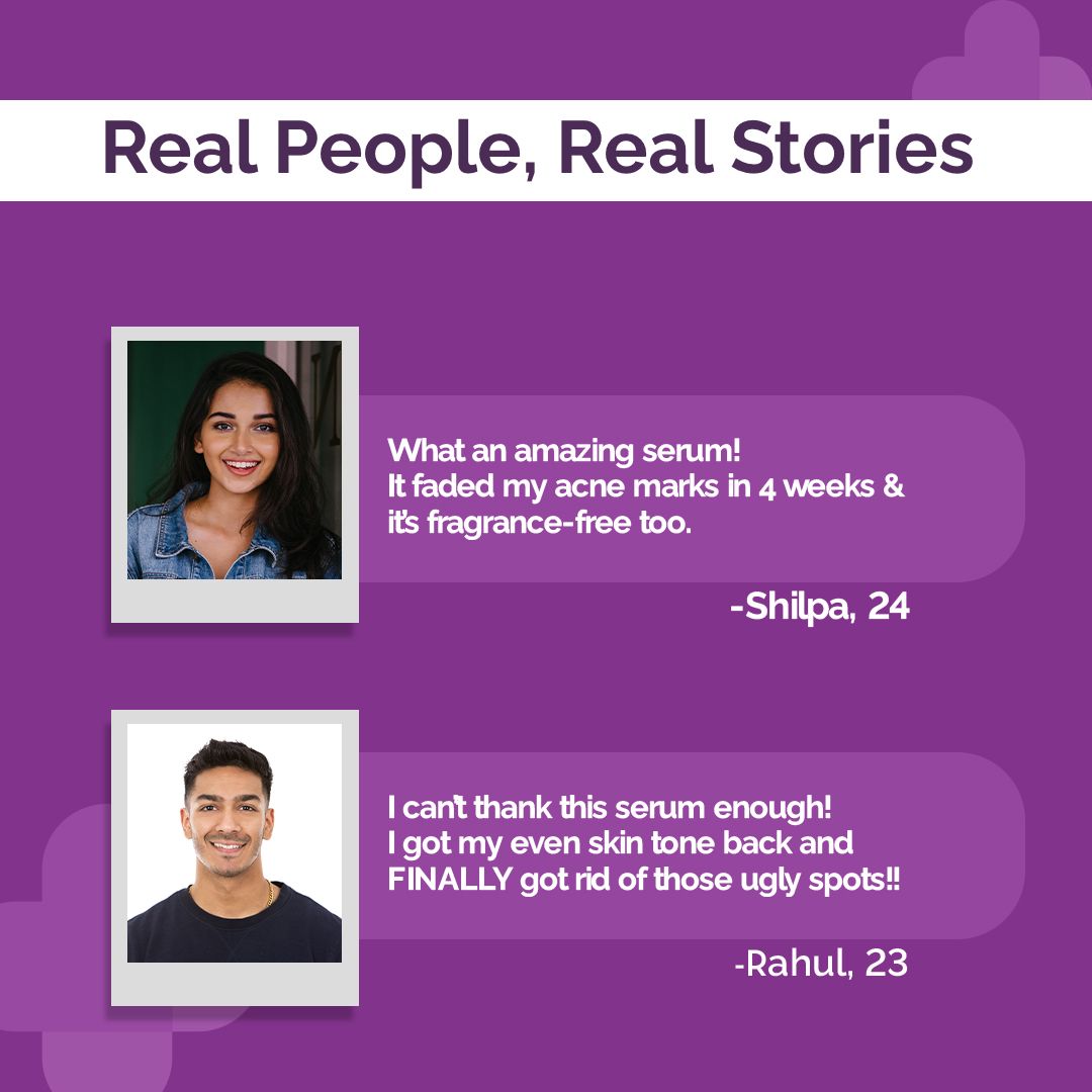 5% Niacinamide Daily Face Serum with Alpha Arbutin & Multivitamin  - 30ml